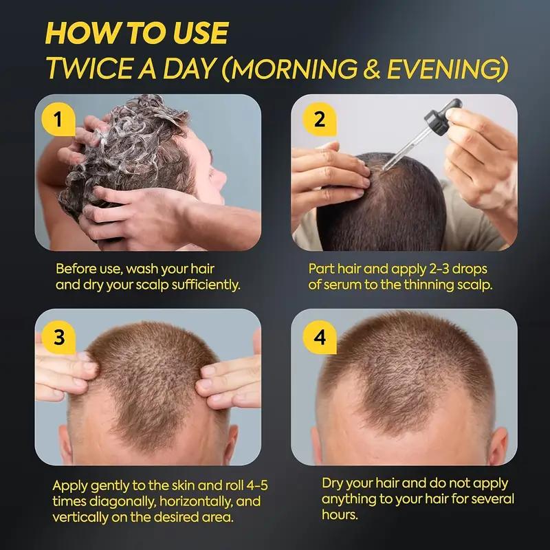 5% Minoxidil Hair Growth Solution – for Men’S Hair & Beard, Women’S Hair Loss Treatment, 1Oz Scalp Comfort Formula